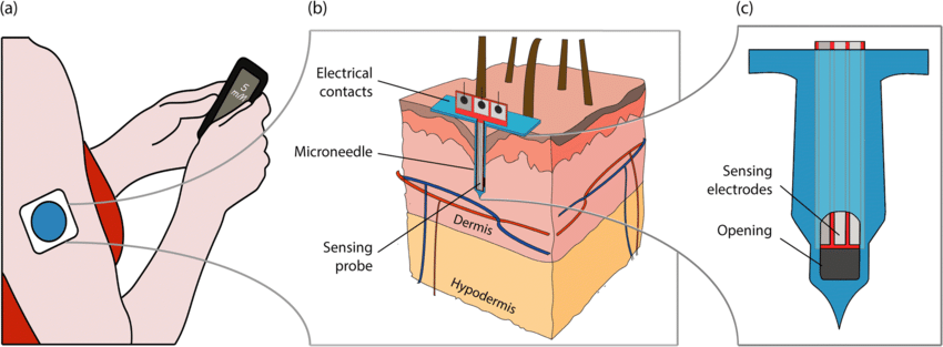a Illustration of the typical implementation of a commercial CGM system